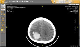 Brain CT Scan Brain CT Scan